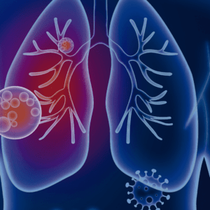 Doenças Respiratórias